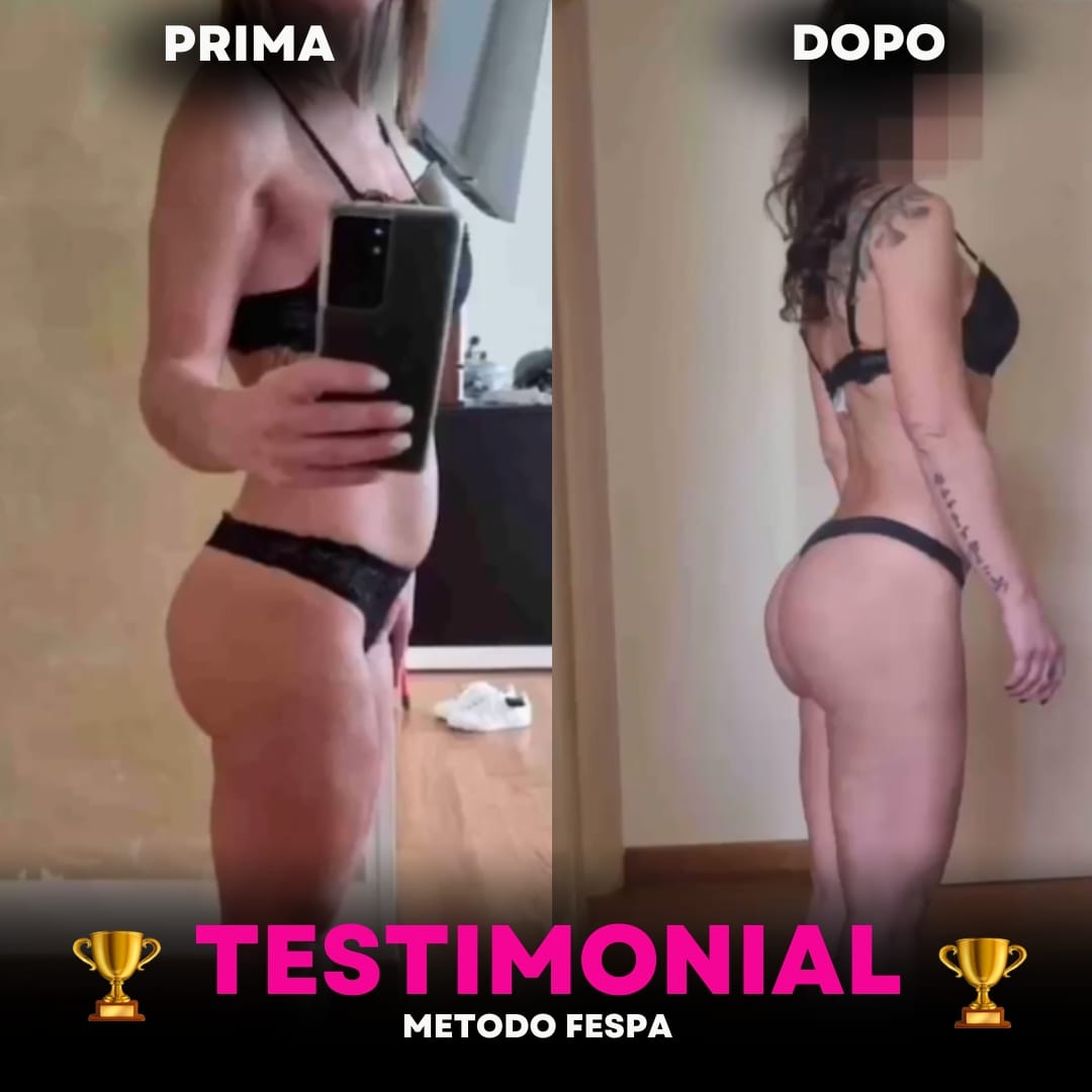 Real FESPA Method result: before and after photo